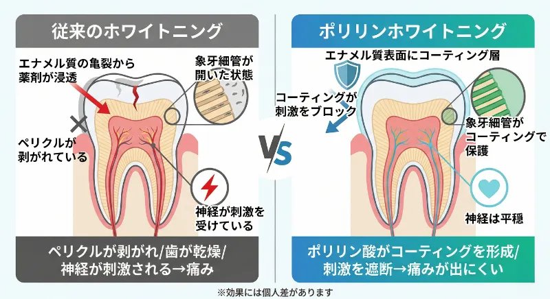 メカニズムの違いの図解