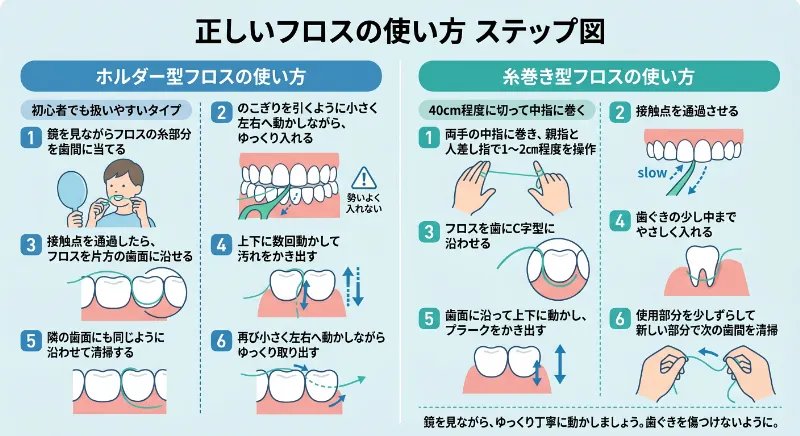 正しいフロスの使い方ステップ図