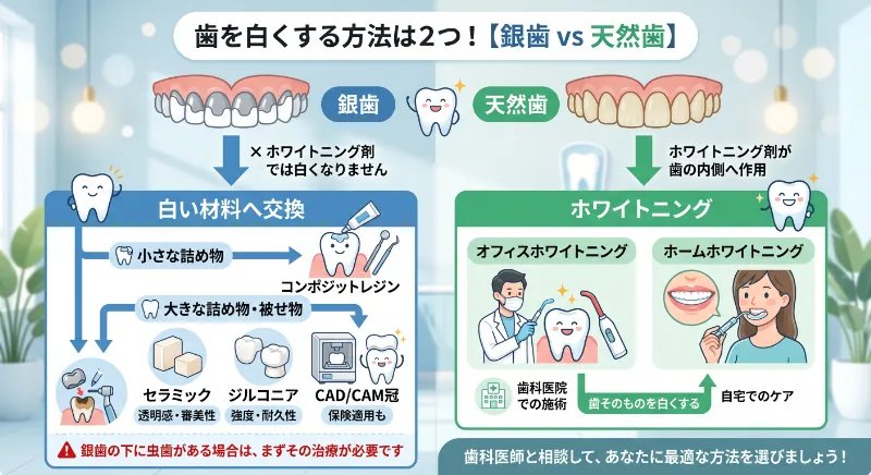 銀歯＝白い材料へ交換／天然歯＝ホワイトニングの2分岐図