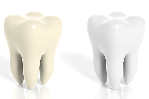 白い歯と黄色い歯の模型