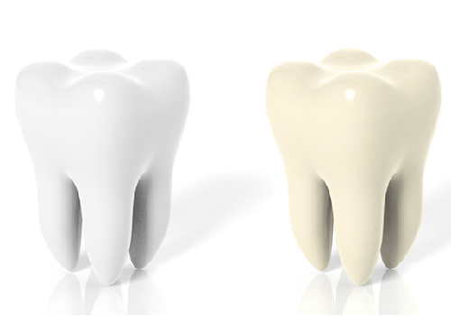 白い歯と黄ばんだ歯のイメージ