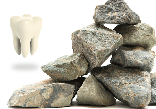 歯と石