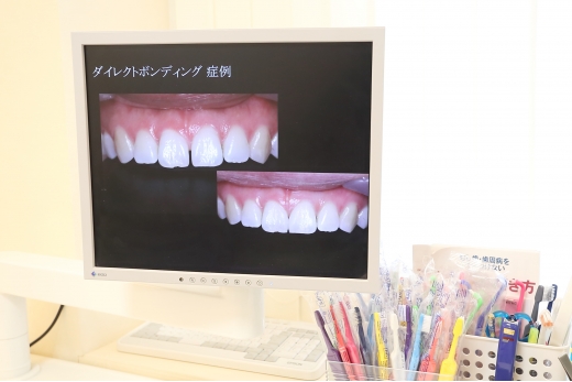 野中歯科・矯正歯科の症例写真