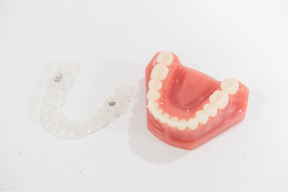 歯の模型とマウスピース