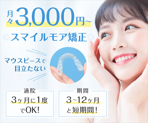 スマイルモア矯正