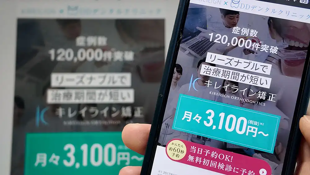 キレイライン矯正