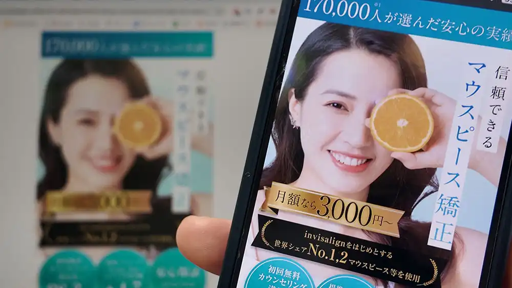 スマイルモア矯正