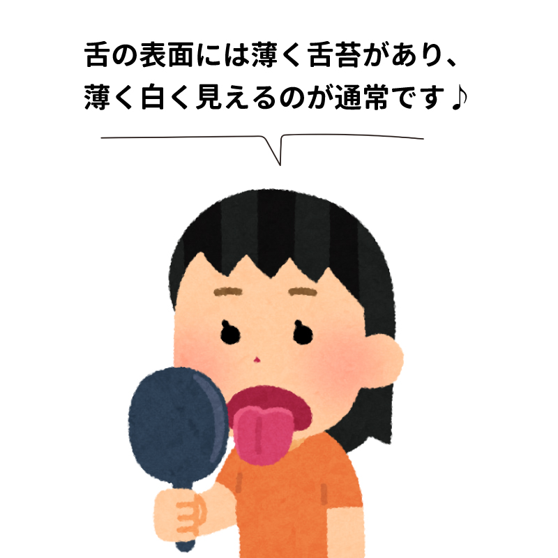 舌の苔って 臭いの原因だけじゃない舌の汚れ 池袋駅前デンタルクリニック 公式 ミュゼホワイトニング